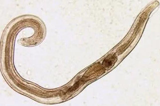 parassiti dell'uomo pinworm